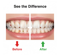 Smart Water Flosser Teeth Cleaner For Cleaning Teeth