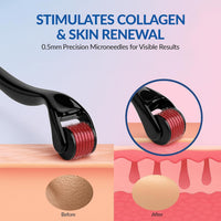 Treatment Roller